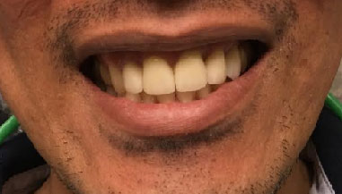 Dentist South Barrington IL gallery  image