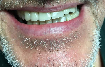 Dentist South Barrington IL gallery  image