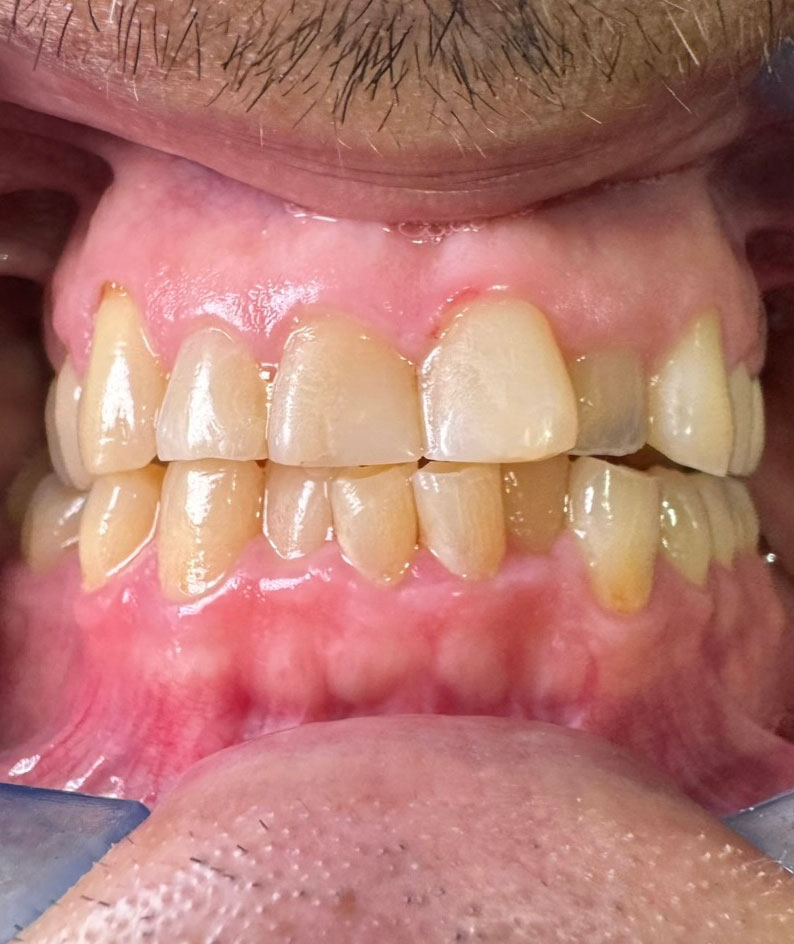 Dentist South Barrington IL gallery  image