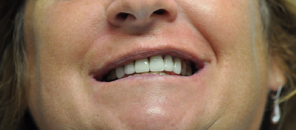 Dentist South Barrington IL gallery  image