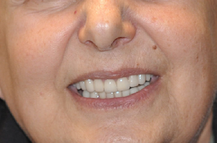 Dentist South Barrington IL gallery  image