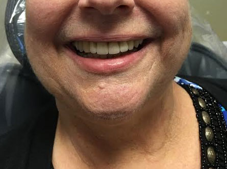 Dentist South Barrington IL gallery  image