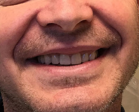 Dentist South Barrington IL gallery  image