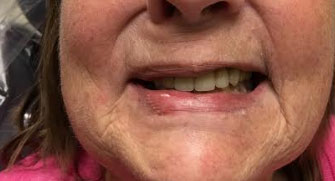 Dentist South Barrington IL gallery  image