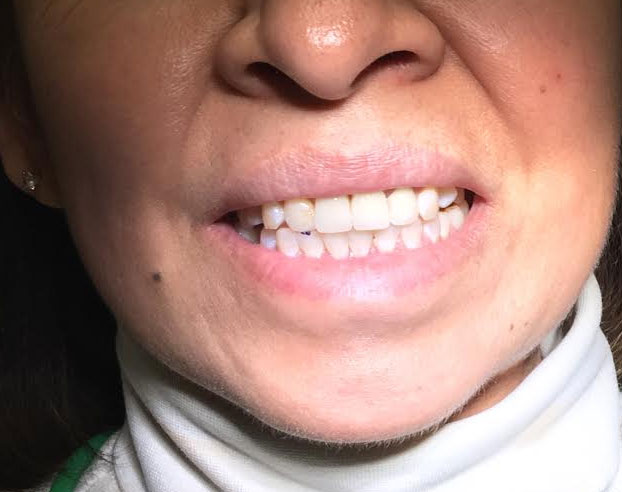 Dentist South Barrington IL gallery  image