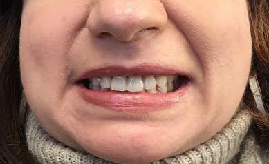 Dentist South Barrington IL gallery  image