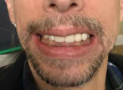 Dentist South Barrington IL gallery  image