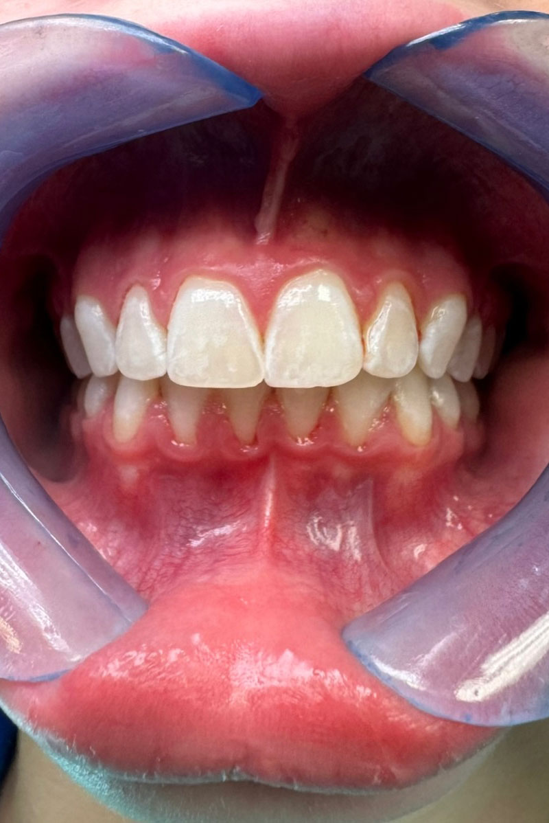 Dentist South Barrington IL gallery  image