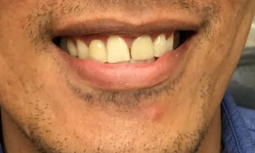 Dentist South Barrington IL gallery  image