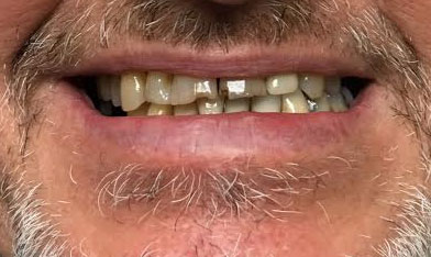 Dentist South Barrington IL gallery  image