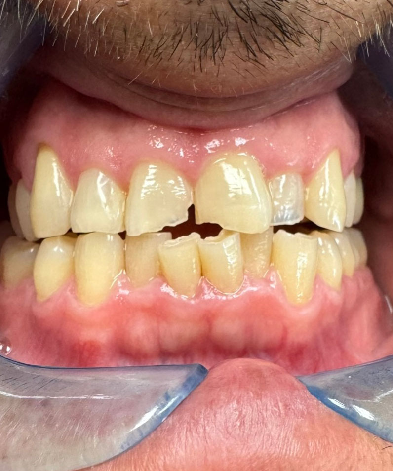 Dentist South Barrington IL gallery  image