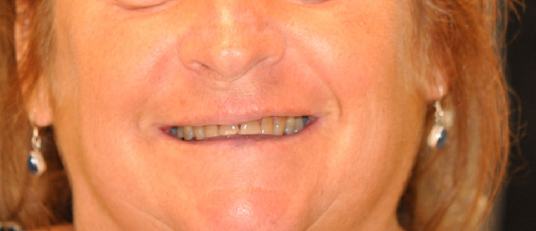 Dentist South Barrington IL gallery  image