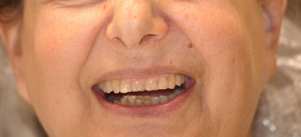 Dentist South Barrington IL gallery  image