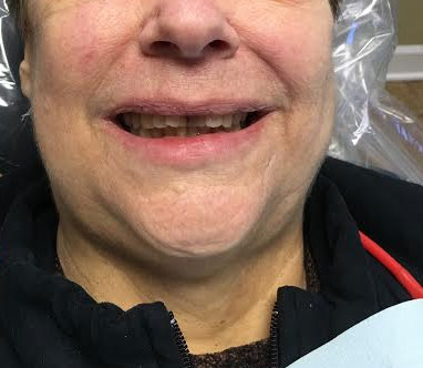 Dentist South Barrington IL gallery  image