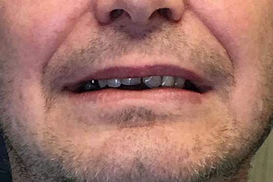 Dentist South Barrington IL gallery  image