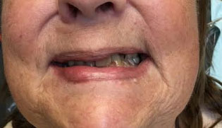 Dentist South Barrington IL gallery  image