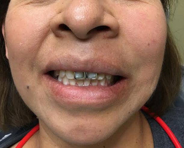 Dentist South Barrington IL gallery  image