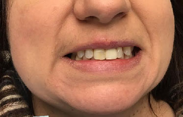 Dentist South Barrington IL gallery  image