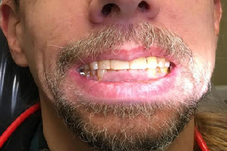 Dentist South Barrington IL gallery  image