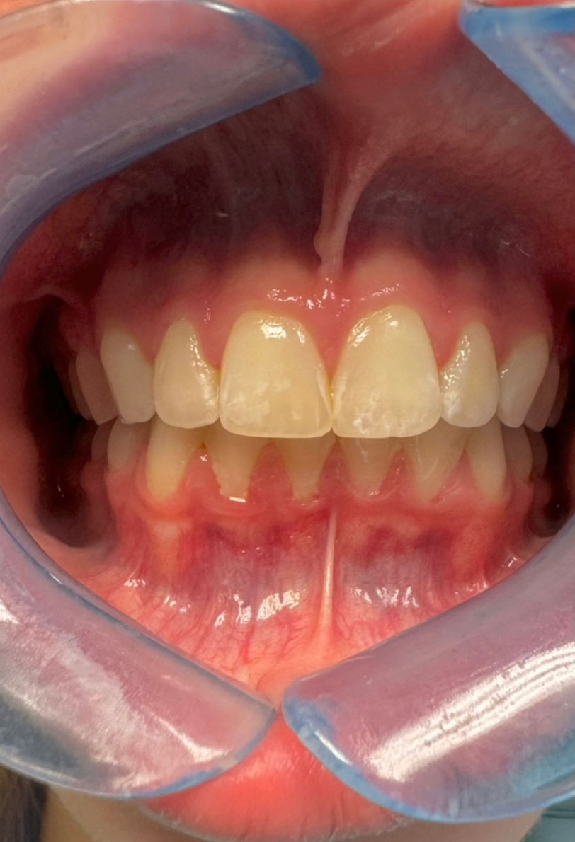 Dentist South Barrington IL gallery  image